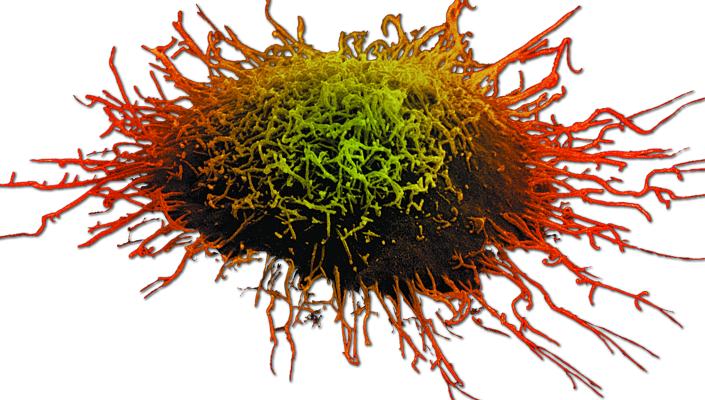 large microscopy image of a cervical cancer cell