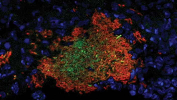 Yersinia replicating in the mouse spleen. Slow-growing bacteria responding to nitric oxide (red) protect interior bacteria (green). Neutrophils (blue) surround the bacterial cluster. Image courtesy of Kim Davis.