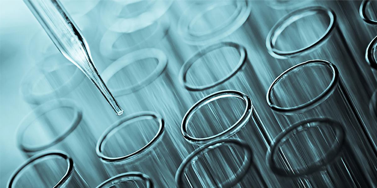 photo of a pipette above an array of flasks