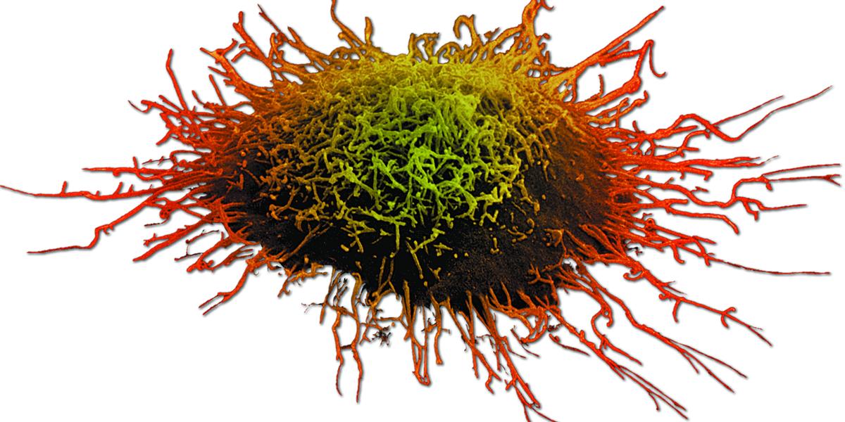 large microscopy image of a cervical cancer cell