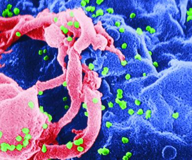 illustration of a cell infected with HIV